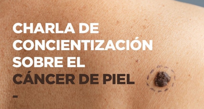PREVENCIÓN DEL CÁNCER DE PIEL